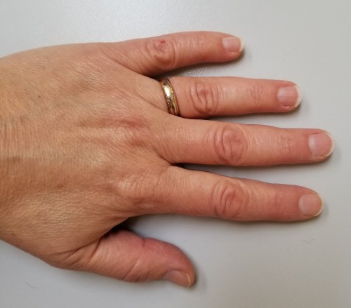 Miriah Hetherington hand